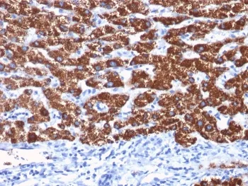 Hepatocyte Specific Antigen Antibody - image 1