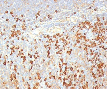 Plasma Cell Marker Antibody - image 1