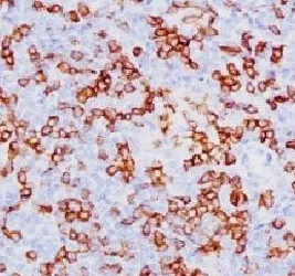 CD8A Antibody - image 1