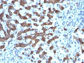 CPS1 Antibody - image 1