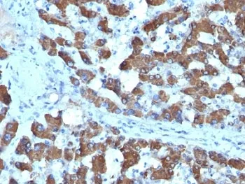CPS1 Antibody - image 1