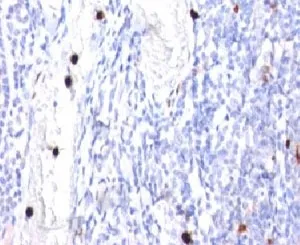 CSF3 Antibody / Granulocyte-Colony Stimulating Factor - image 1
