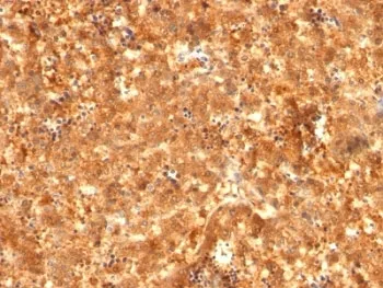 Alpha Fetoprotein / AFP Antibody Cocktail - image 1