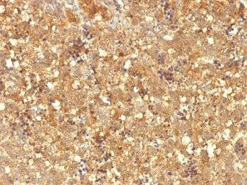 Alpha Fetoprotein / AFP Antibody - image 1