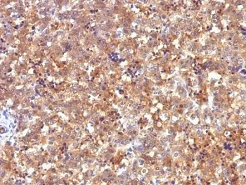 Alpha Fetoprotein / AFP Antibody - image 1