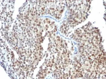 Estrogen Receptor beta Antibody - image 1