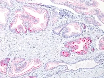 AMACR / p504S Antibody (Prostate Cancer Marker) - image 1