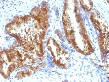 AMACR / p504S Antibody (Prostate Cancer Marker) - image 1