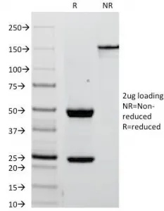Placental Alkaline Phosphatase Antibody / ALPP - image 1