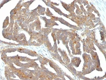 GnRH Receptor Antibody / GNRHR - image 1