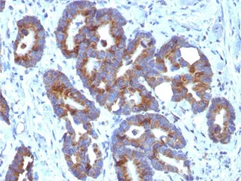 ABO Antibody (Blood Group Antigen A) - image 1