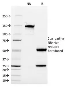 CD13 Antibody / ANPEP - image 1