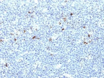 HLA-Aw32 + HLA-A25 Antibody - image 1