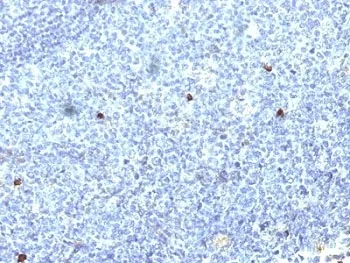 HLA-Aw32 + HLA-A25 Antibody - image 1