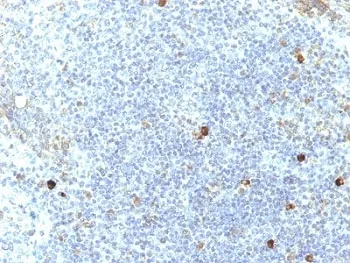 HLA-Aw32 + HLA-A25 Antibody - image 1