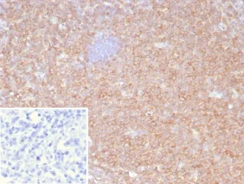 HLA-B Antibody (MHC Class I) - image 1