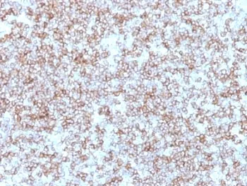 HLA-DP + HLA-DR Antibody (MHC II) - image 1