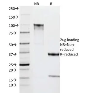 HLA-DR Antibody (MHC II) - image 1