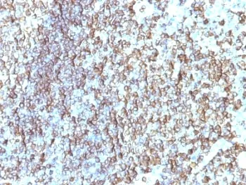 HLA-DRB1 Antibody (MHC II) - image 1