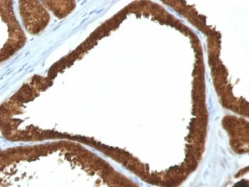 IDH1 Antibody / Isocitrate Dehydrogenase - image 1