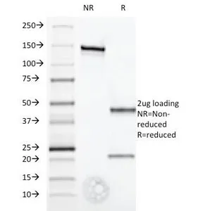 Interferon alpha 1 Antibody / IFNA1 - image 1
