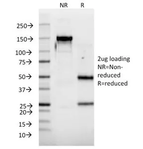 Interferon alpha 2 Antibody / IFNA2 - image 1