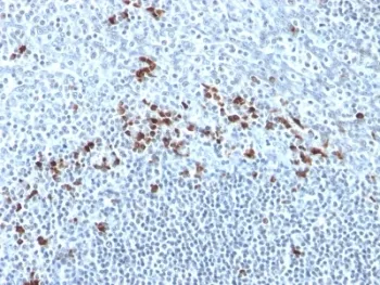Kappa Light Chain Antibody - image 1