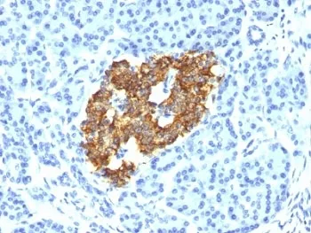 Insulin Antibody - image 1