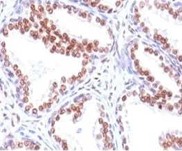 Androgen Receptor Antibody - image 1