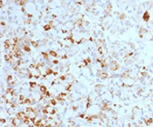 Luteinizing Hormone beta Antibody - image 1
