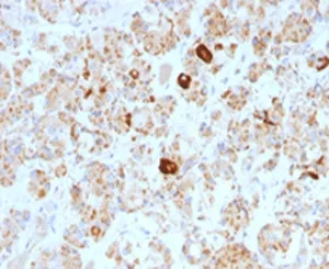 Luteinizing Hormone beta Antibody - image 1
