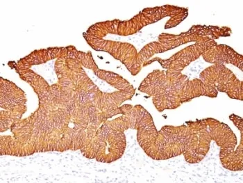 EpCAM Antibody - image 1