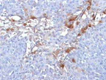 CD146 Antibody / MCAM / MUC18 - image 1