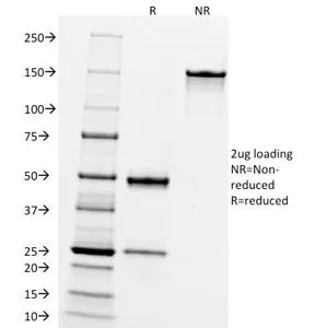 CD10 Antibody / Neprilysin - image 1