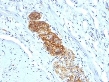 NCAM / CD56 Antibody - image 1