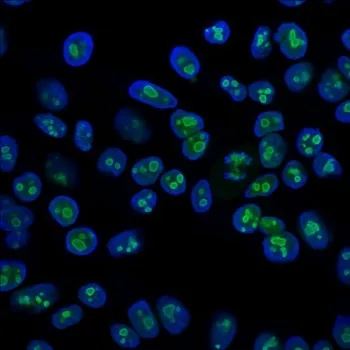 Nucleolin Antibody - image 1