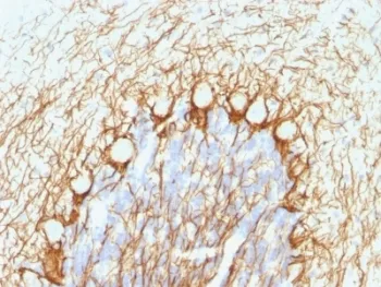 Neurofilament Antibody, phospho (NF-H) - image 1