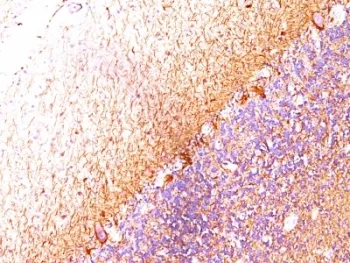 Neurofilament Antibody (-Light) / NF-L / NEFL - image 1