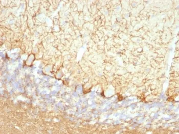 Neurofilament Antibody (-Light) / NF-L / NEFL - image 1