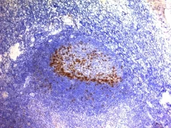 PDCD1 Antibody / PD-1 / PD1 - image 1