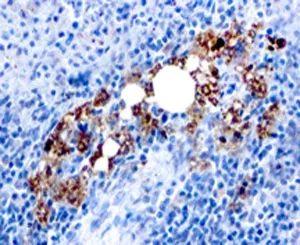 TRAcP Antibody / TRAP / ACP5 - image 1