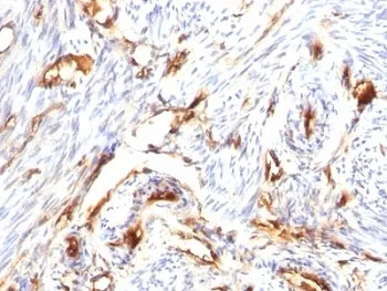 Beta-2 Microglobulin Antibody - image 1