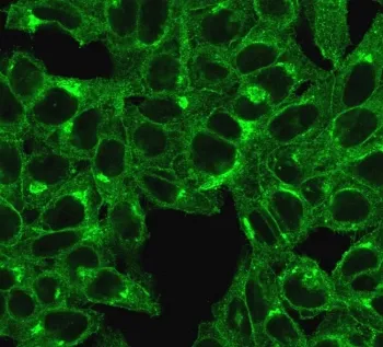 Beta-2 Microglobulin Antibody - image 1