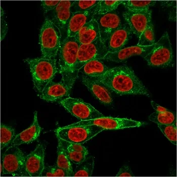Beta-2 Microglobulin Antibody - image 1