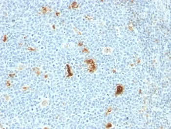 Macrophage Antibody / S100A8/A9 / Calprotectin - image 1
