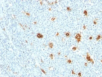 S100A9 Antibody / MRP14 / Calgranulin B / Calprotectin L1H - image 1
