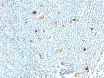 S100A9 Antibody / MRP14 / Calgranulin B / Calprotectin L1H - image 1
