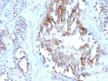 SHBG Antibody (Sex Hormone Binding Globulin) - image 1