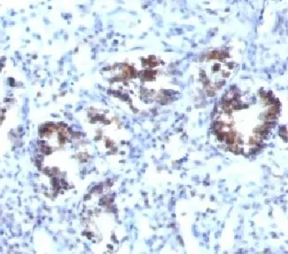 SM22 alpha Antibody / Transgelin - image 1