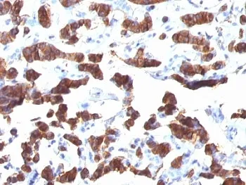 TG Antibody / Thyroglobulin - image 1
